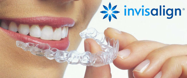 invisalign5