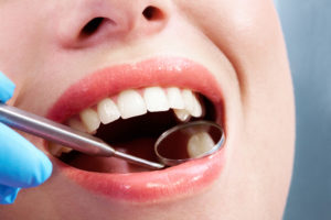 Dental tool dental care teeth