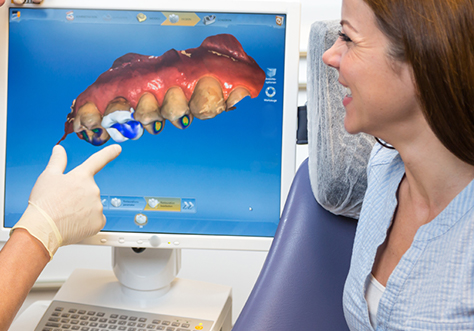 Cerec display